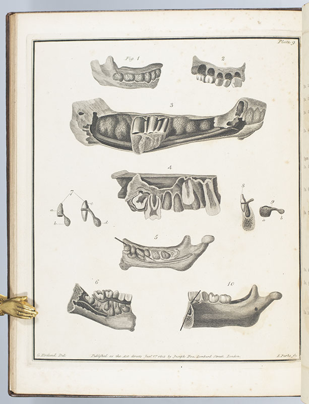 The Natural History of the Human Teeth. Including a Particular Elucidation of the Changes Which Take Place During the Second Dentition, and Describing the Proper Mode of Treatment to Prevent Irregularities of the Teeth. To Which is Added, an Account of the Diseases Which Affect Children During the First Dentition.