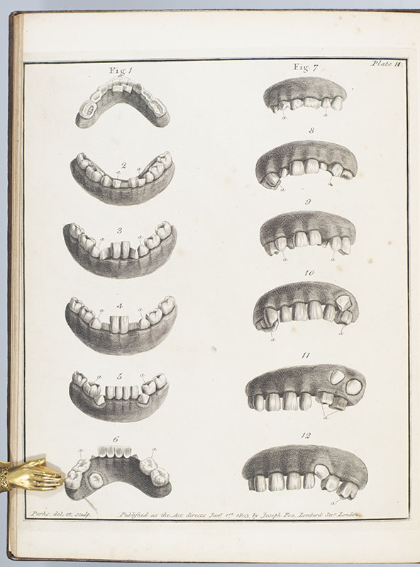 The Natural History of the Human Teeth. Including a Particular Elucidation of the Changes Which Take Place During the Second Dentition, and Describing the Proper Mode of Treatment to Prevent Irregularities of the Teeth. To Which is Added, an Account of the Diseases Which Affect Children During the First Dentition.