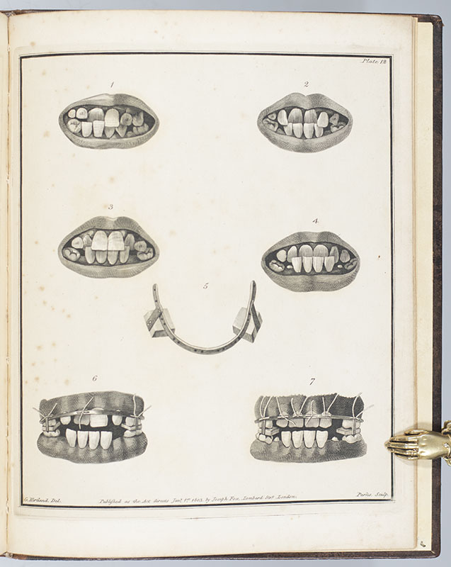 The Natural History of the Human Teeth. Including a Particular Elucidation of the Changes Which Take Place During the Second Dentition, and Describing the Proper Mode of Treatment to Prevent Irregularities of the Teeth. To Which is Added, an Account of the Diseases Which Affect Children During the First Dentition.