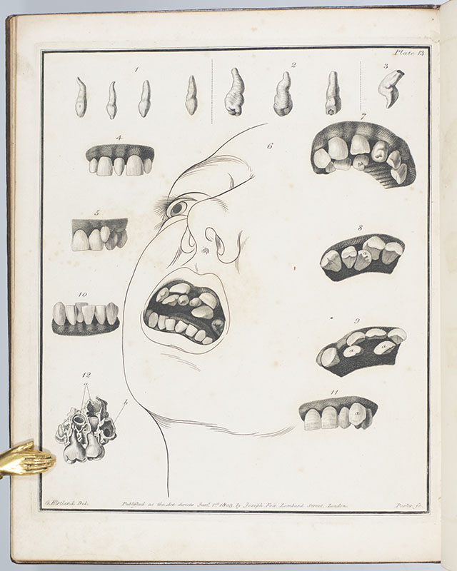 The Natural History of the Human Teeth. Including a Particular Elucidation of the Changes Which Take Place During the Second Dentition, and Describing the Proper Mode of Treatment to Prevent Irregularities of the Teeth. To Which is Added, an Account of the Diseases Which Affect Children During the First Dentition.