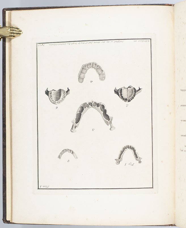 The Natural History of the Human Teeth. Including a Particular Elucidation of the Changes Which Take Place During the Second Dentition, and Describing the Proper Mode of Treatment to Prevent Irregularities of the Teeth. To Which is Added, an Account of the Diseases Which Affect Children During the First Dentition.