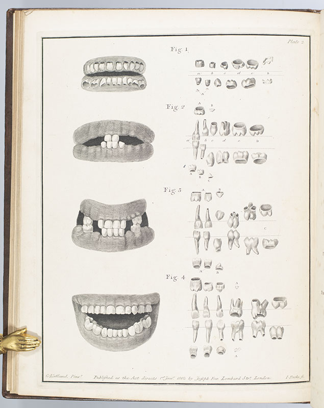 The Natural History of the Human Teeth. Including a Particular Elucidation of the Changes Which Take Place During the Second Dentition, and Describing the Proper Mode of Treatment to Prevent Irregularities of the Teeth. To Which is Added, an Account of the Diseases Which Affect Children During the First Dentition.