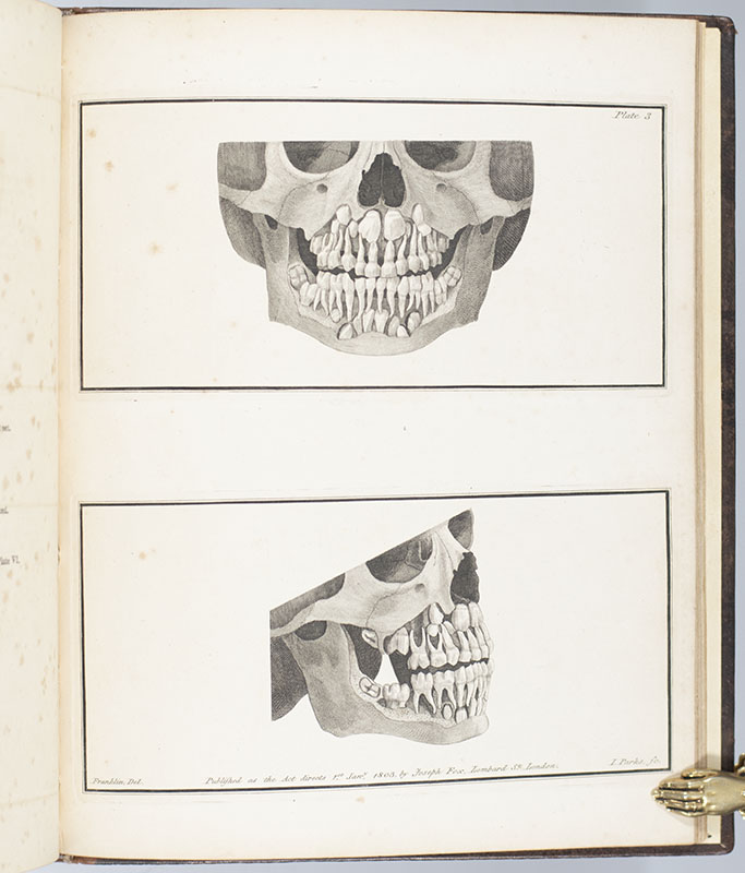 The Natural History of the Human Teeth. Including a Particular Elucidation of the Changes Which Take Place During the Second Dentition, and Describing the Proper Mode of Treatment to Prevent Irregularities of the Teeth. To Which is Added, an Account of the Diseases Which Affect Children During the First Dentition.