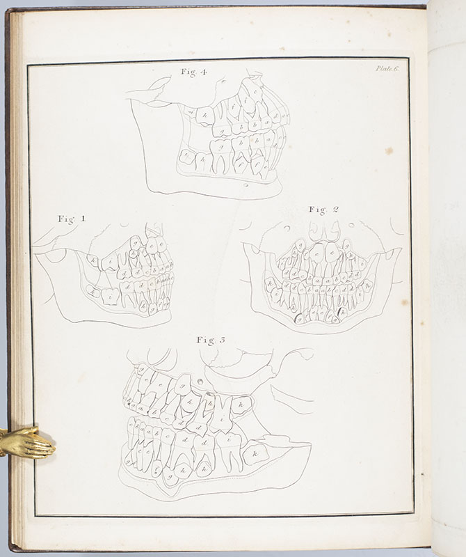The Natural History of the Human Teeth. Including a Particular Elucidation of the Changes Which Take Place During the Second Dentition, and Describing the Proper Mode of Treatment to Prevent Irregularities of the Teeth. To Which is Added, an Account of the Diseases Which Affect Children During the First Dentition.