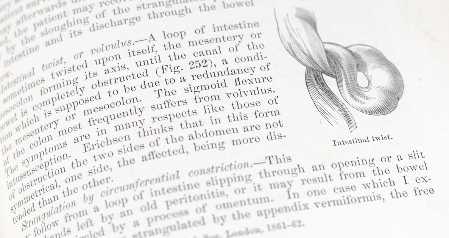 The Principles and Practice of Surgery.