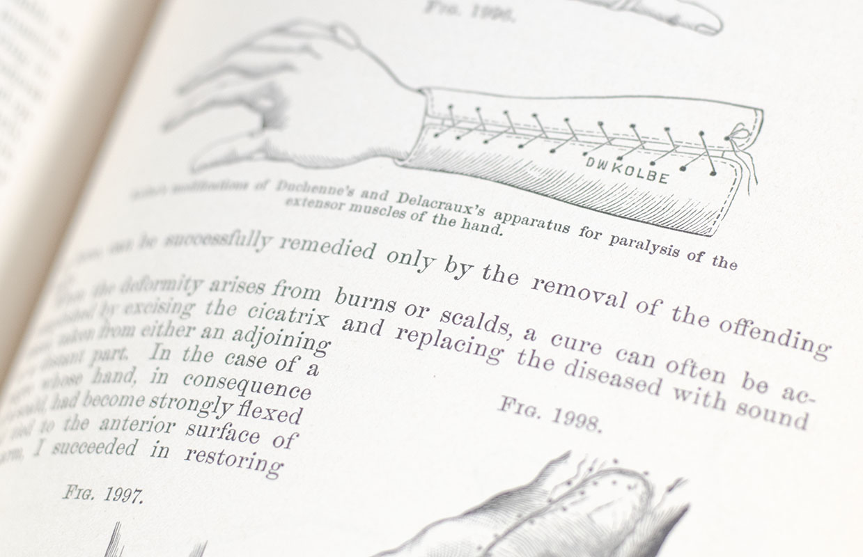 The Principles and Practice of Surgery.